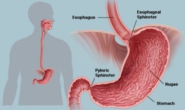 যেসব লক্ষণে বুঝবেন পাকস্থলীর ক্যান্সার