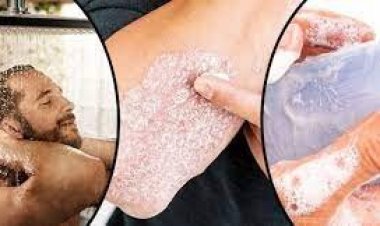 শীতে গোসলের যে ভুলে হতে পারে চর্মরোগ