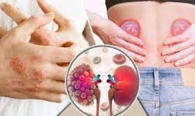 কিডনি রোগের যে লক্ষণ ফুটে ওঠে ত্বকে