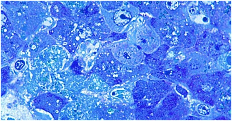 লাসা ভাইরাসে ব্রিটেনে ৩ মৃত্যু, মহামারির শঙ্কা