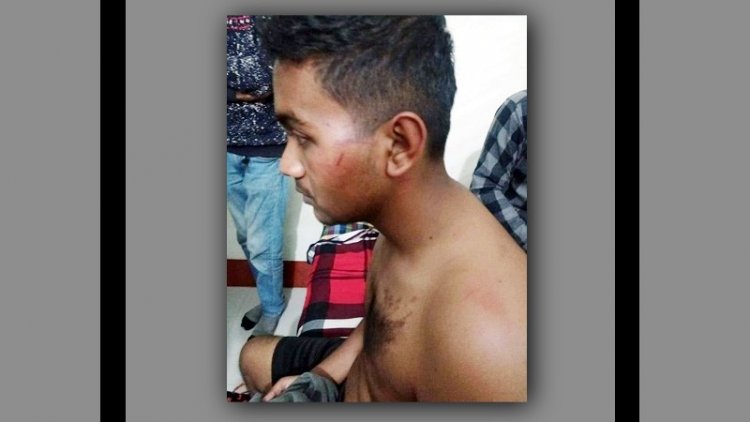 ছাত্রলীগ করার প্রস্তাব না মানায় শিক্ষার্থীকে রাতভর নির্যাতন!!
