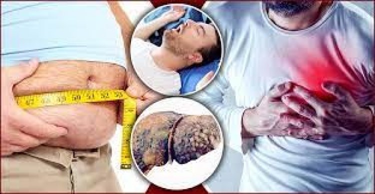 স্থূলতা যে ৯ রোগের কারণ