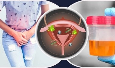 প্রস্রাবের সময় ব্যথা ও জ্বালাপোড়ার ৫ কারণ