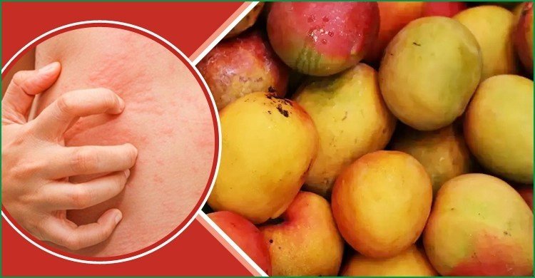 আম যাদের জন্য হতে পারে ক্ষতিকর