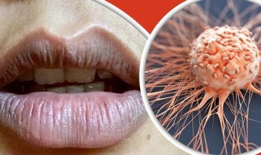 ঠোঁট কালো হয়ে যাওয়া যেসব রোগের লক্ষণ