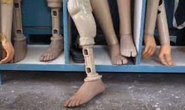 কৃত্রিম হাত-পা সংযোজনে ফুটপাতের দোকানই ভরসা