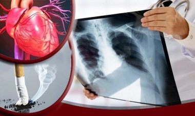 যে ৫ কারণে ধূমপান ছাড়তে বলেন বিশেষজ্ঞরা