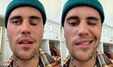  বিরল রোগে আক্রান্ত জাস্টিন বিবার, অবশ হয়ে গেছে মুখ