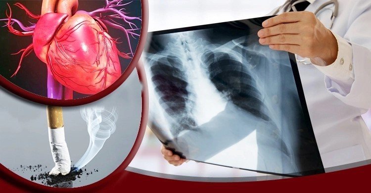 যে ৫ কারণে ধূমপান ছাড়তে বলেন বিশেষজ্ঞরা