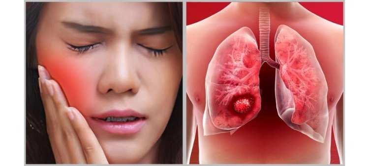 ফুসফুসের ক্যানসারের যে লক্ষণ ফুটে ওঠে মুখে