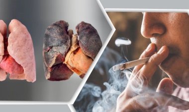 যে ৫ খাবারে ধূমপায়ীদের ফুসফুসও হবে পরিষ্কার!