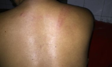 ছাত্রদল নেতা  হিমেলের  ওপর  ছাত্রলীগের সশস্ত্র হামলা