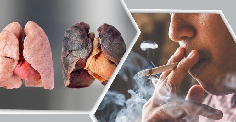 যে ৫ খাবারে ধূমপায়ীদের ফুসফুসও হবে পরিষ্কার!