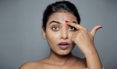 মুখের দাগ দূর করবে এই ৩ ফেসপ্যাক