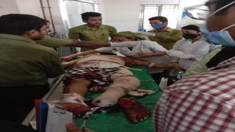 মঠবাড়িয়ায় দুর্বৃত্তদের কোপে জাপা নেতার পা বিচ্ছিন্ন