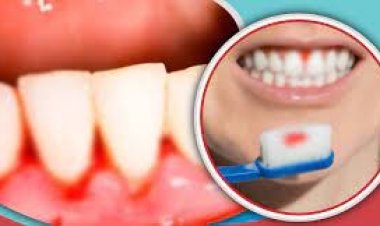 দাঁত ব্রাশ করার সময় যে কারণে রক্ত পড়ে