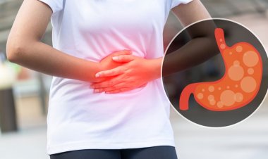 অ্যাসিডিটি দূর করবে যে ৫ খাবার