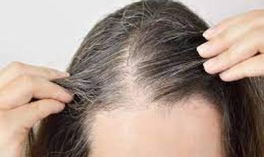 কম বয়সেই অনেকের চুল পেকে যায়
