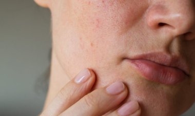 ত্বক দেখেই বুঝবেন আপনি কোন রোগে আক্রান্ত