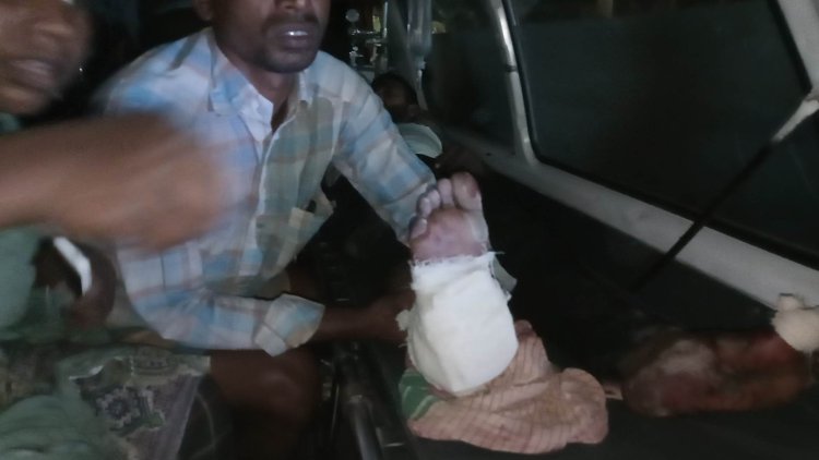 কুড়িগ্রামে কুড়িয়ে পাওয়া মর্টারশেল বিস্ফোরণে এক ব্যক্তির ডান পায়ের গোড়ালী বিচ্ছিন্ন