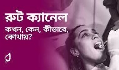 দাঁতে গর্ত হলে রুট ক্যানেল না ফিলিং?