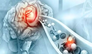 জেনে নিন স্ট্রোকের অস্বাভাবিক লক্ষণগুলো 