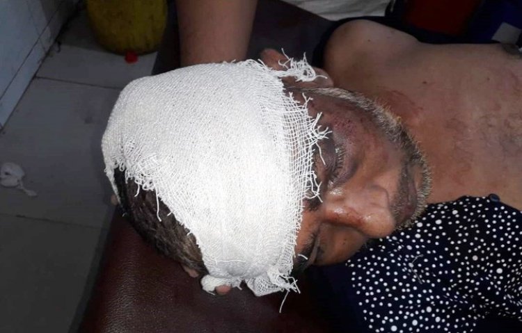 ভোলার-চরফ্যাশনে সাংবাদিক আদিত্য জাহিদকে দ্বিতীয় দফায় কুপিয়ে জখম