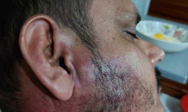 সরিষাবাড়ীতে চাঁদা না দেয়ায়  ব্যবসায়ীকে পিটিয়েছে এমপি’র ক্যাডার বাহিনীঃ থানায় অভিযোগ