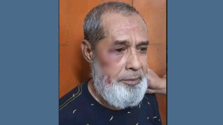 জামালপুর জেলা আ.লীগের সহ-সভাপতিকে মারধর, আটক ১