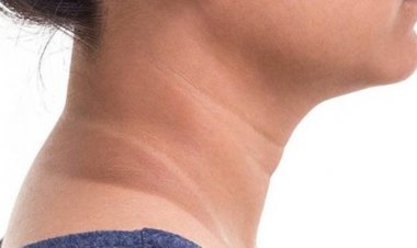 ৮ কৌশলে দূর হবে গলা ও ঘাড়ের কালচে দাগ