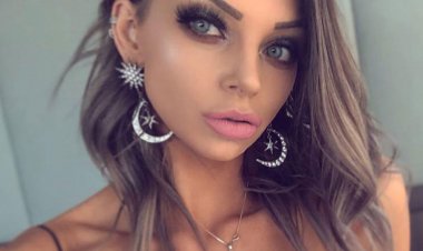  আদুরে পোষা কুকুরের কামড়ে ছিন্নভিন্ন দেহ, মৃত্যুর সঙ্গে লড়ছেন নারী