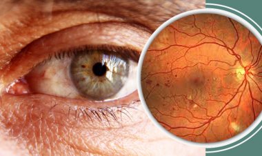 ডায়াবেটিস রোগীদের চোখে যেসব সমস্যা হতে পারে