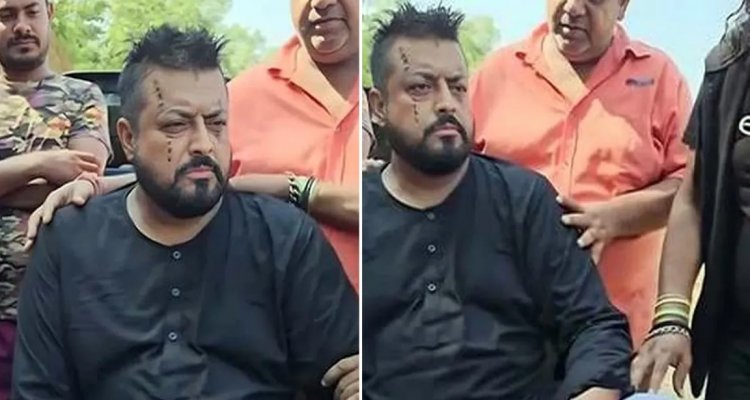 শুটিং সেটে সাপের কামড়ে আহত ওমর সানী