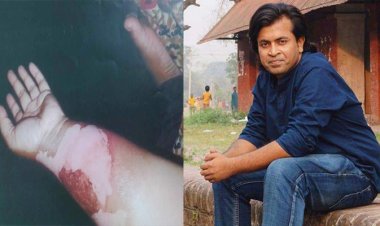 পরকীয়া জেনে যাওয়ায় স্ত্রীকে ঝলসে দেন চবি শিক্ষক