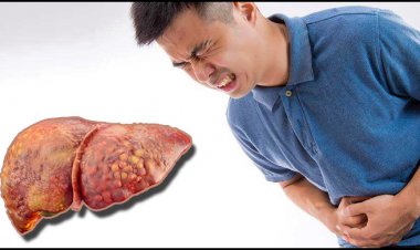  যেসব খাবার নিয়মিত খেলে ফ্যাটি লিভার হতে পারে