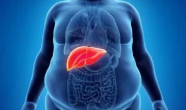 দেশে সাড়ে চার কোটি মানুষ ফ্যাটি লিভারে আক্রান্ত