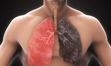 ফুসফুসে ক্যানসারের লক্ষণ বুঝবেন যেভাবে