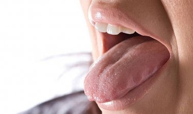 জিহ্বায় ঘা, অবহেলা না করে দ্রুত নিন ব্যবস্থা