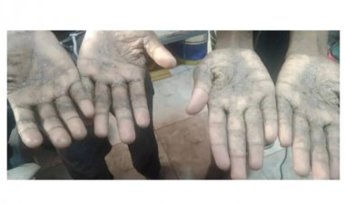 লিবিয়ায় বিক্রি হওয়া দুই বাংলাদেশির ভয়াবহ বেঁচে ফেরার গল্প